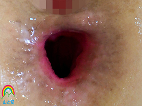 働く女子はアナルマゾ BEST 12時間 サンプル動画サムネイル